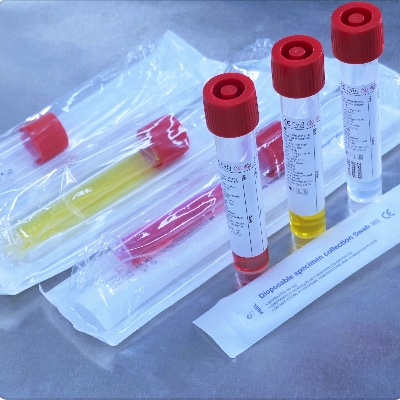 5 ตัวชี้วัดประสิทธิภาพที่มองไม่เห็นของ Viral Transport Medium